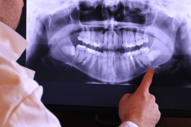 Best Emergency Treatment for Dental Infections or Abscesses in Queens Gate, PA